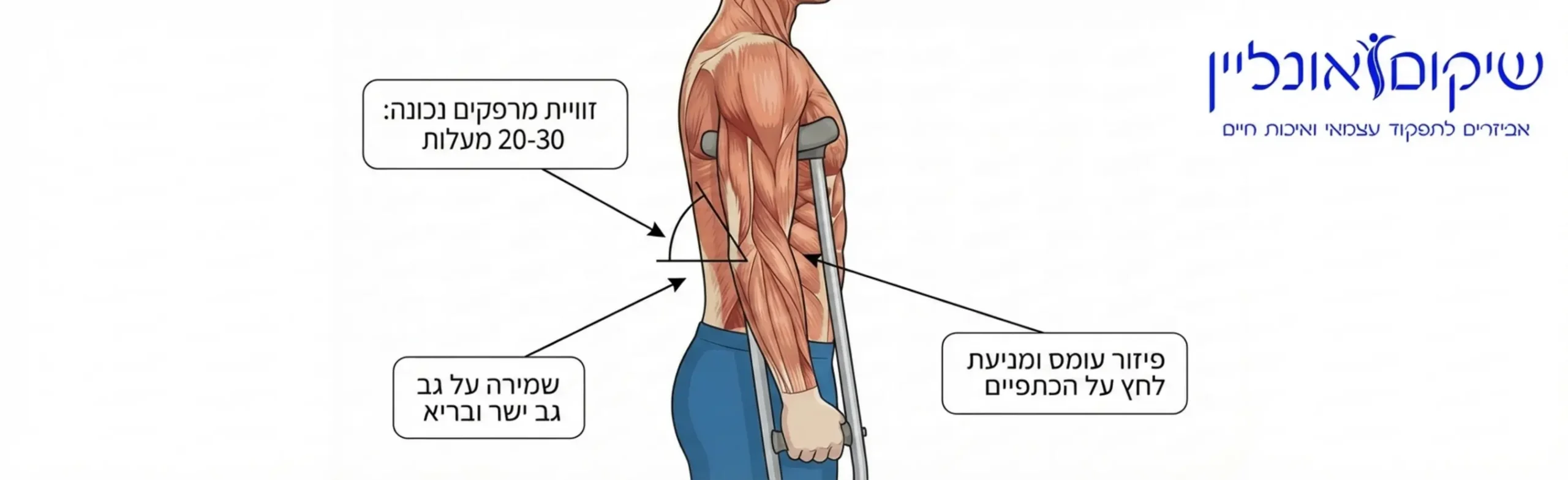 איור רפואי המדגים את היציבה הנכונה ואת הזווית המדויקת של המרפקים בעת שימוש בקביים קנדיות כדי למנוע עומס על הכתפיים ולשמור על מנח גב ישר ובריא