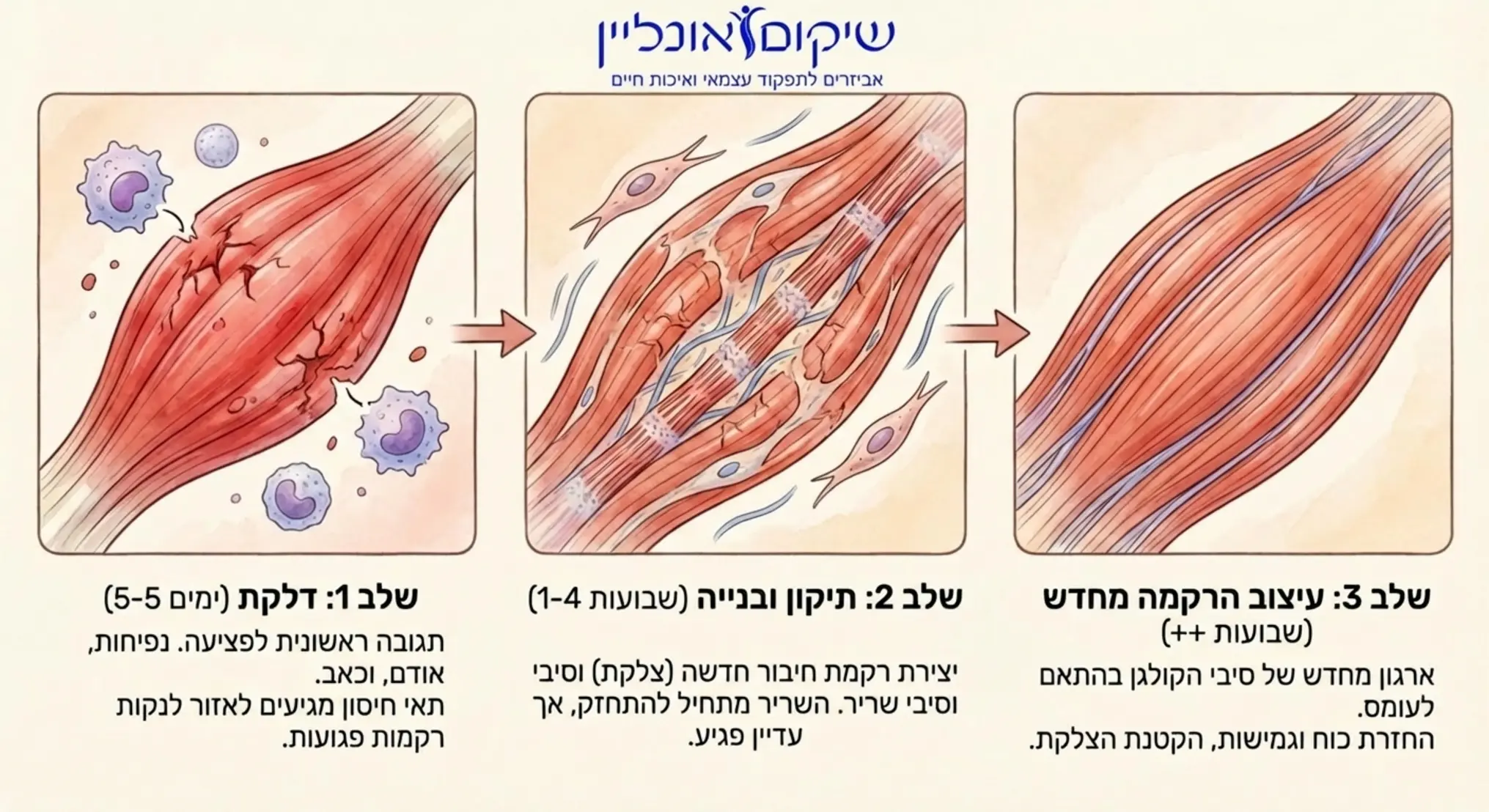 אינפוגרפיקה המציגה את שלושת שלבי ההחלמה של שריר לאחר פציעה, החל משלב הדלקת ועד לשלב עיצוב הרקמה מחדש, עם איורים רפואיים עדינים של סיבי שריר