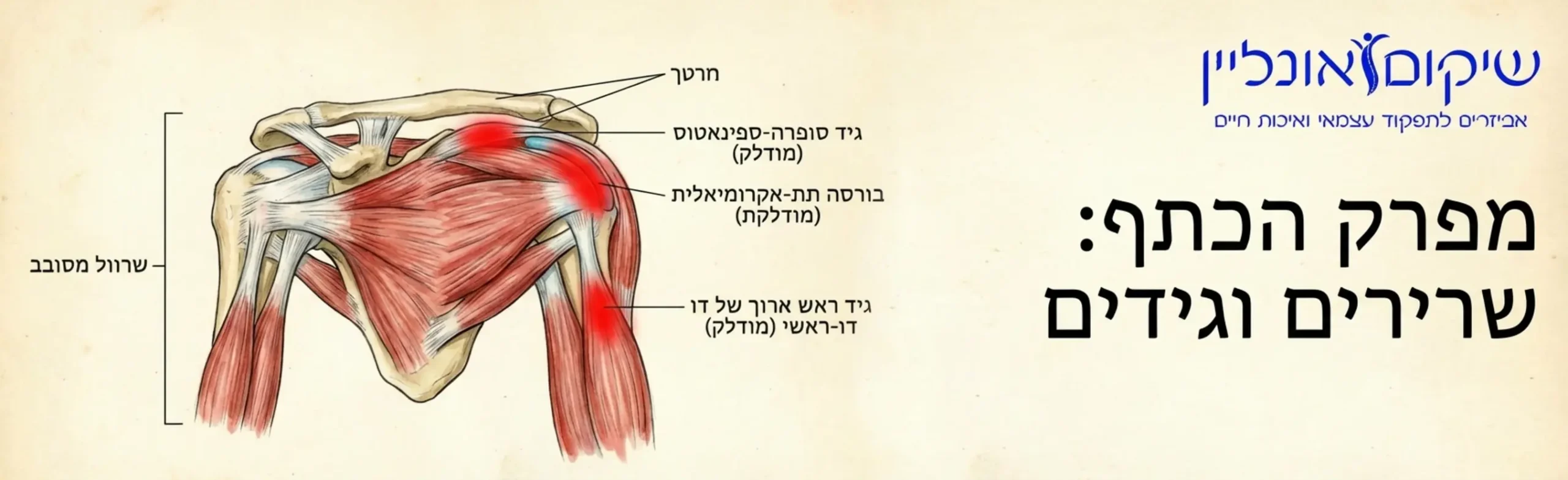 איור אנטומי של מפרק הכתף המראה את השרירים והגידים, עם הדגשה באדום על אזורי דלקת נפוצים המגבילים תנועה