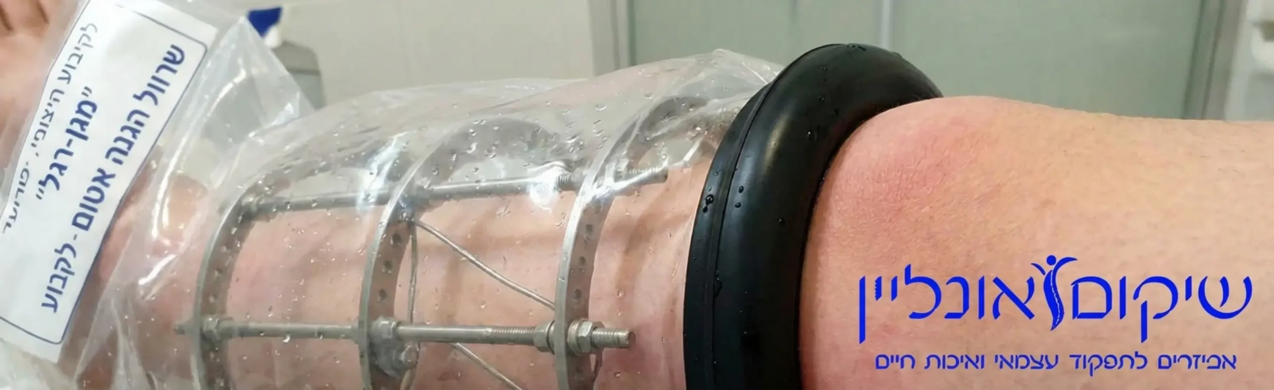 צילום תקריב איכותי של מטופל המשתמש בשרוול אטום למים על רגל עם קיבוע חיצוני מסוג אליזרוב, השרוול רחב מספיק כדי להכיל את טבעות המתכת, ורואים את טבעת הסיליקון השחורה נצמדת באופן מושלם לאזור הירך העליונה כדי למנוע חדירת מים