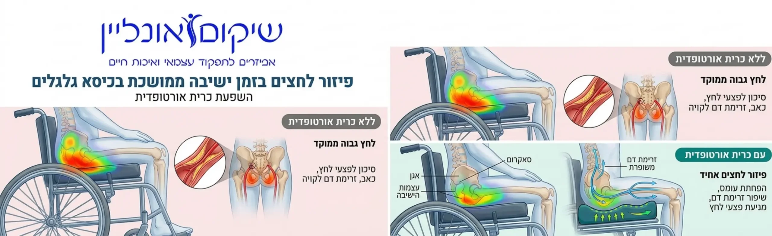 אינפוגרפיקה המציגה את פיזור הלחצים על גוף האדם בזמן ישיבה ממושכת בכיסא גלגלים, עם דגש על אזורי האגן וכיצד כרית אורטופדית מפחיתה את העומס ומעודדת זרימת דם